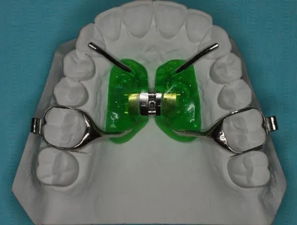 Детские пластинки: пластинка с винтом